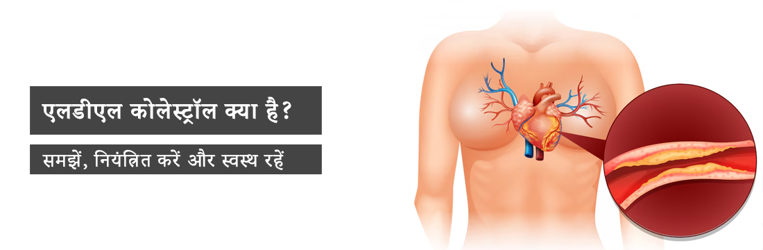  LDL Cholesterol in Hindi: समझें, नियंत्रित करें और स्वस्थ रहें